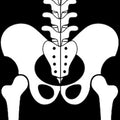 X-Ray